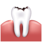 Cavities or Infection