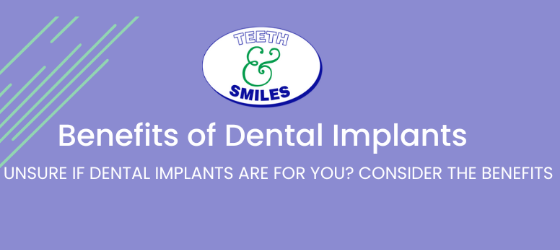 Teeth & Smiles Benefits of Dental implants