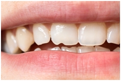cosmetic treatments